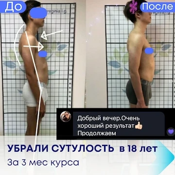 Результат лікування